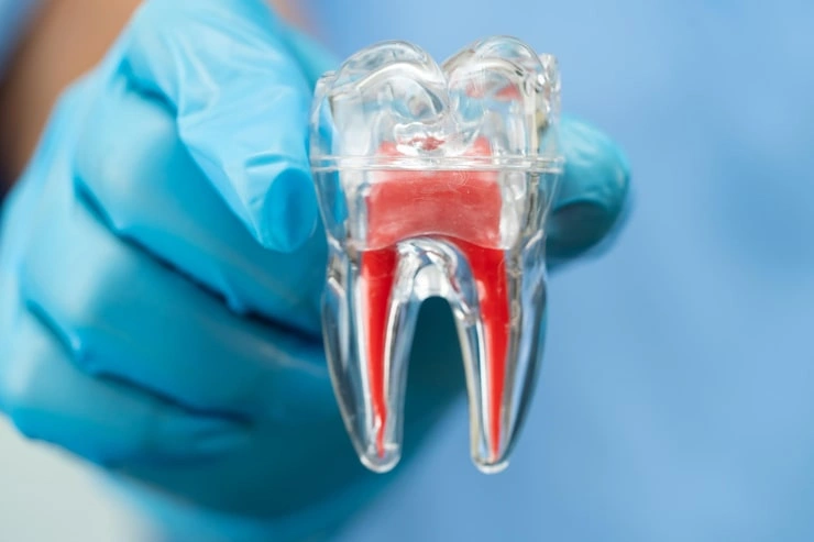 asian dentist holding dental implant artificial tooth roots into jaw root canal dental treatment gum disease teeth model dentist 39768 17927