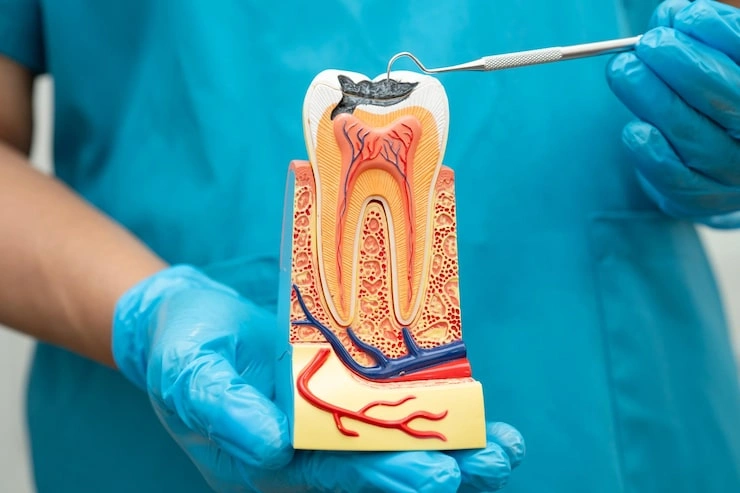asian dentist holding dental implant artificial tooth roots into jaw root canal dental treatment gum disease teeth model dentist 39768 18625