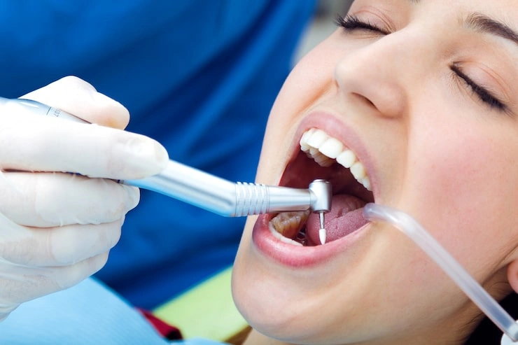checkup dentist tool instrument young 1301 3124
