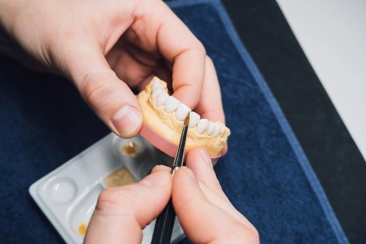 dental technician dentist working with tooth dentures model laboratory prosthetic dentistr 698893 789