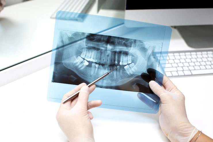 dentist analyzes x ray photo 140725 7685