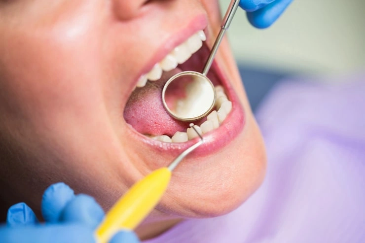 dentist examining female patient teeth 107420 74141 1