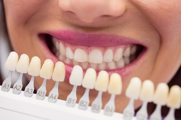 dentist examining female patient with teeth shades 107420 65412