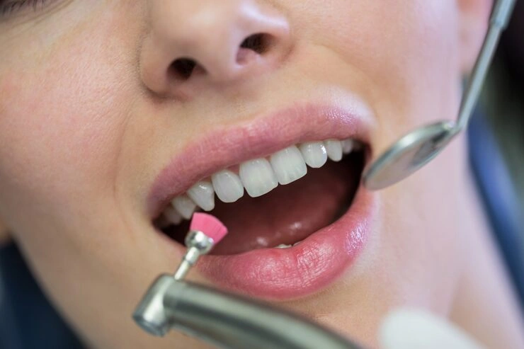 dentist examining female patient with tools 107420 74185