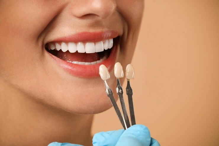 doctor checking young woman39s teeth color beige background closeup dental veneers 495423 102127