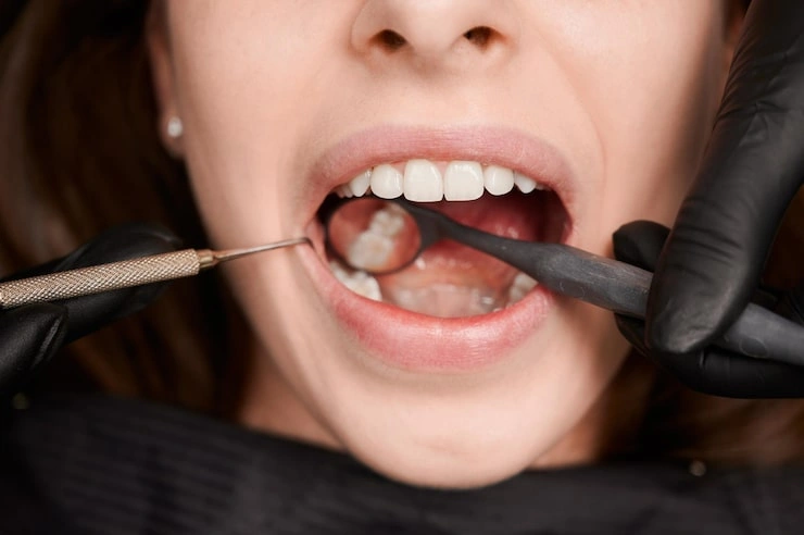 macro photography beautiful female smile with white healthy teeth 651396 3429 1