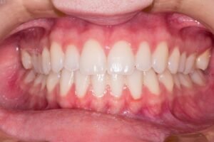 Choosing the best cosmetic dentist at a dental clinic in Thornhill